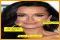 Botox, Implants & More! – Hollywood Life